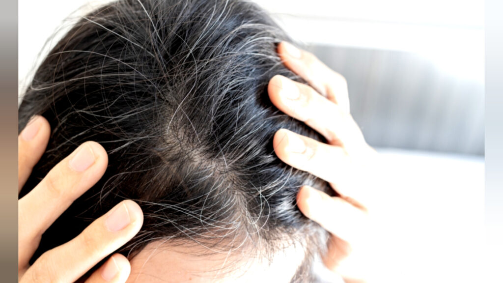 White Hair : తెల్లజుట్టు పీకేస్తే మరింత ఎక్కువ అవుతుందా? శాస్త్రీయ వాస్తవాలు,  తీసుకోవాల్సిన జాగ్రత్తలు!