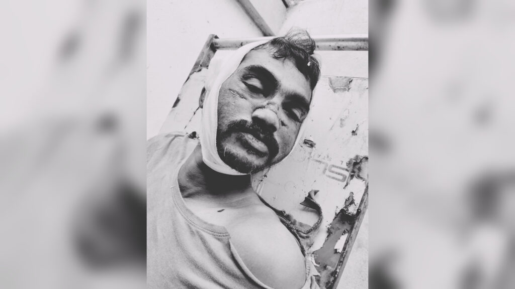 Miryalaguda : రోడ్డు ప్రమాదంలో గుర్తు తెలియని వ్యక్తి మృతి..!